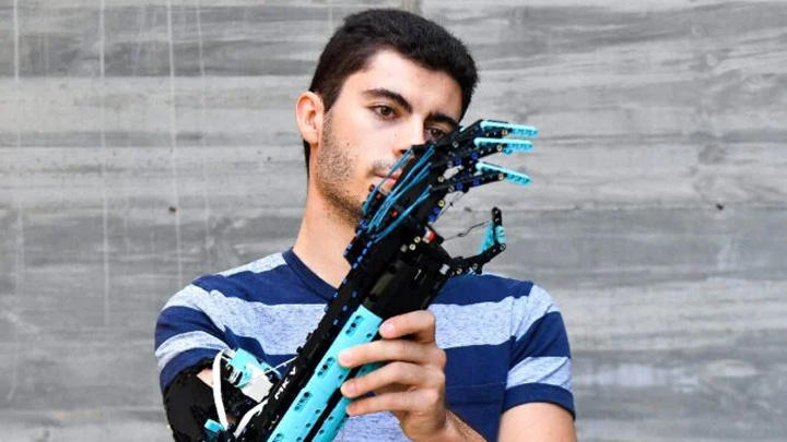 El estudiante universitario andorrano David Aguilar, 22 años, afectado por el síndrome de Poland, muestra su prótesis de brazo fabricada por él mismo con piezas de Lego. / Foto: AFP