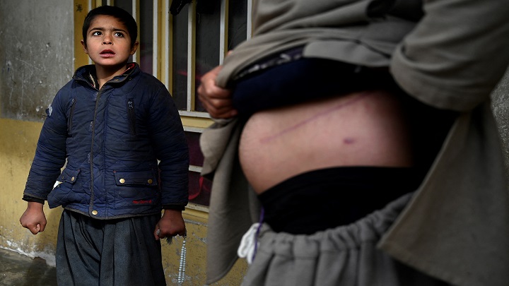 Afganos venden un riñón para sobrevivir 
