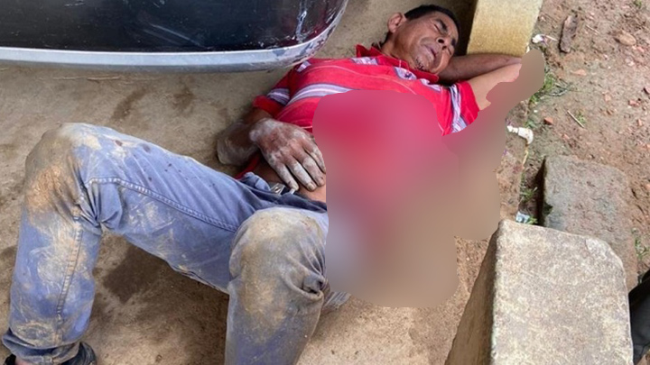 El misterio detrás del brutal ataque a un obrero en Cúcuta./Foto: cortesía