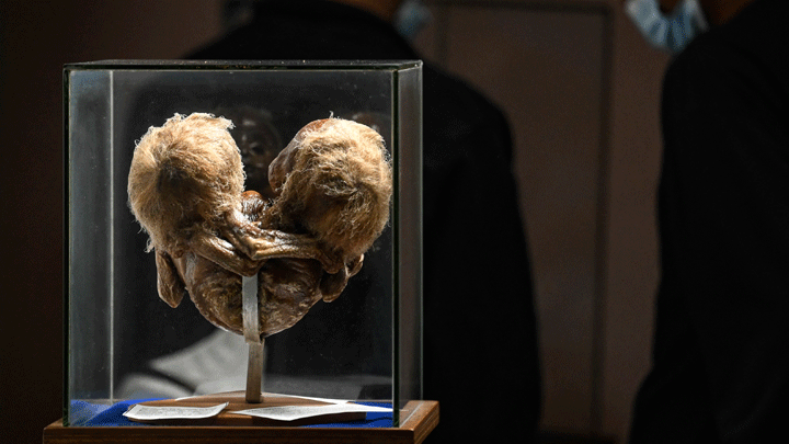 Los tesoros macabros de un Museo del Ser Humano en Colombia