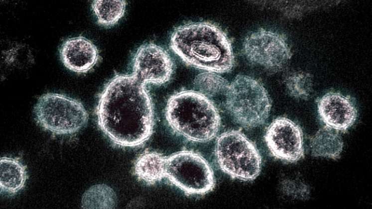 Según los expertos, la transmisión del virus a través de un animal es una hipótesis “entre probable y muy probable”. /Foto: AFP