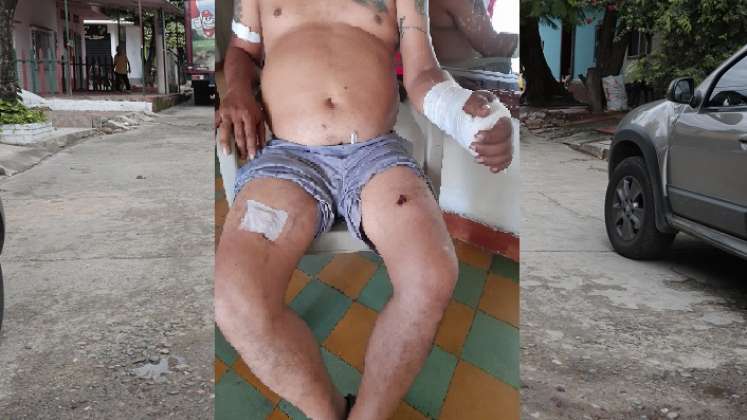 Jhon Jairo Orozco Vargas sobrevivió a un ataque a bala.