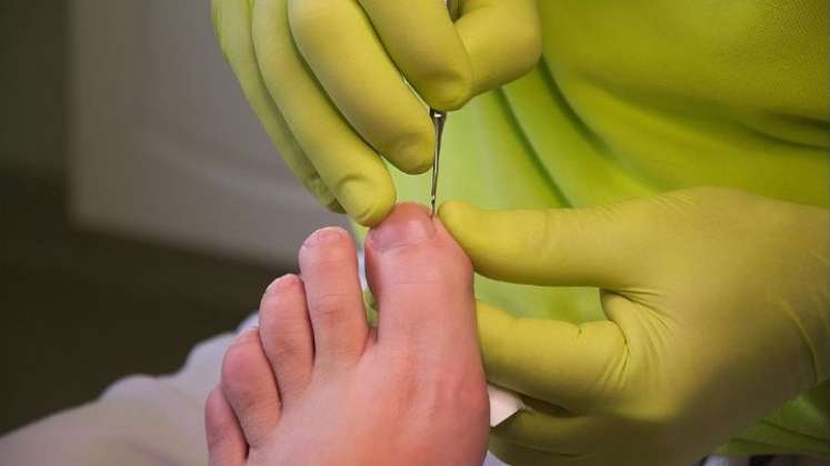 En el país existe la Escuela Colombiana de Podología, donde se ofertan diferentes programas para tratar las afecciones de los pies. Pero, un médico o enfermero también se pueden especializar. 